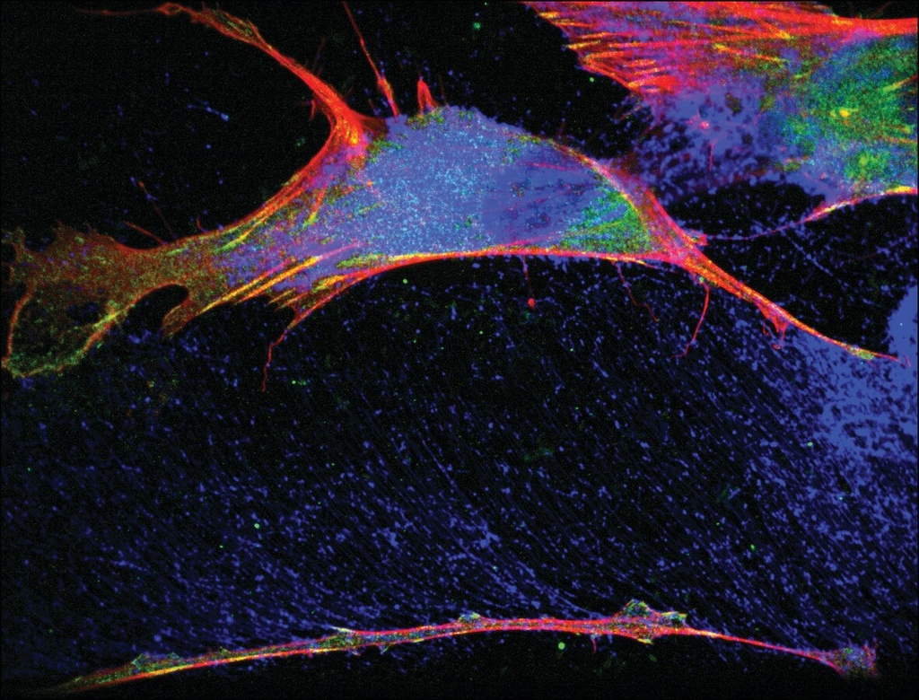 [V9131-100UL] Monoclonal Anti-Vinculin antibody produced in mouse (100 μL)