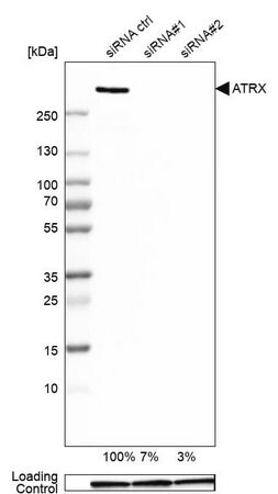 [HPA001906-100UL] Anti-ATRX antibody produced in rabbit (100 μL)