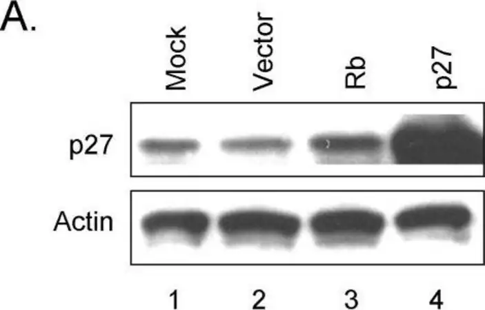 [A2066-.2ML] Anti-Actin antibody produced in rabbit (0.2 mL)