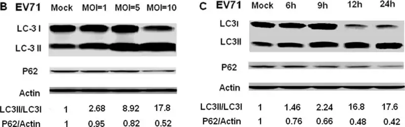 [L7543-100UL] Anti-LC3B antibody produced in rabbit (100 μL)