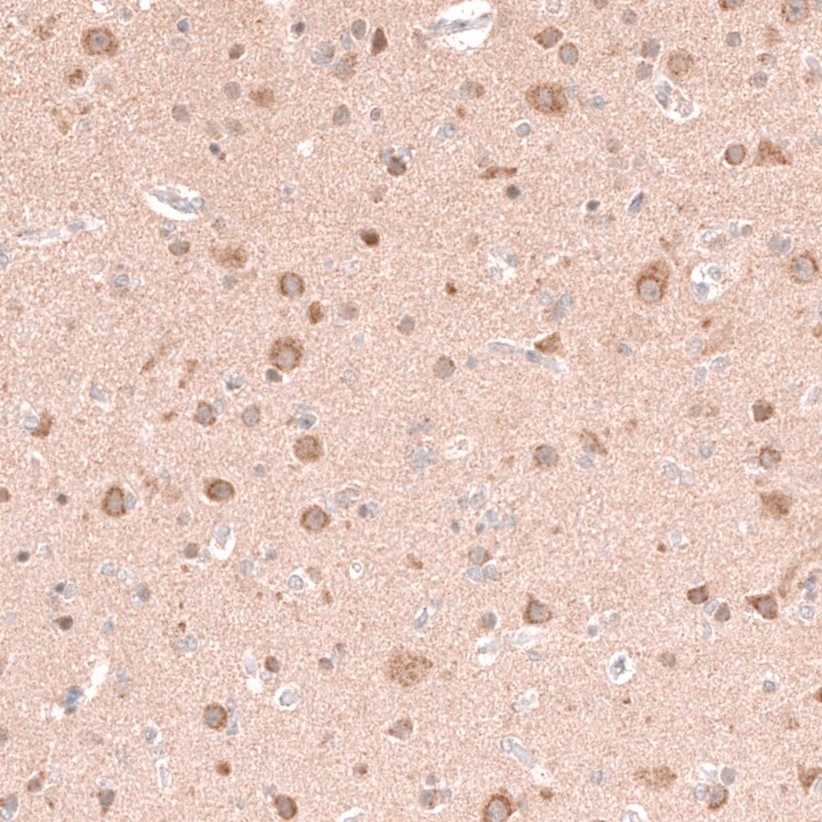 [HPA051535-100UL] Anti-NELL1 antibody produced in rabbit (100 μL)