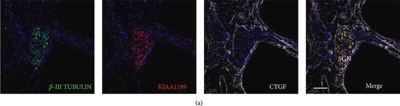 [T8660-.2ML] Monoclonal Anti-β-Tubulin III antibody produced in mouse (0.2 mL)