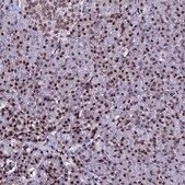 [HPA041189-100UL] Anti-H2AFX antibody produced in rabbit (100 μL)