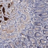 [HPA035827-100UL] Anti-CHRD antibody produced in rabbit (100 μL)