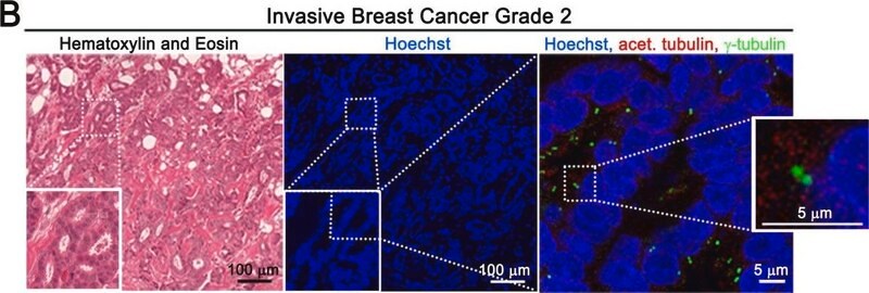 [T5326-100UL] Anti-γ-Tubulin antibody, Mouse monoclonal (100 μL)