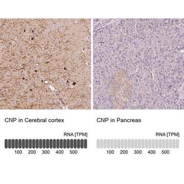 [HPA023278-100UL] Anti-CNP antibody produced in rabbit (100 μL)