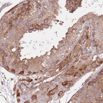 [HPA049587-100UL] Anti-RNF19B antibody produced in rabbit (100 μL)