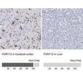 [HPA014518-100UL] Anti-P2RY12 antibody produced in rabbit (100 μL)