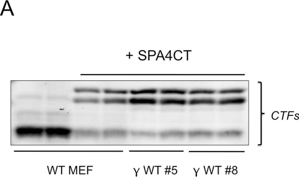 [A8717-25UL] Anti-Amyloid Precursor Protein, C-Terminal antibody produced in rabbit (25 μL)