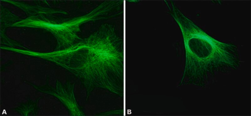 [T4026-.2ML] Monoclonal Anti-β-Tubulin antibody produced in mouse (0.2 mL)