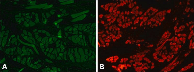 [M1570-200UL] Anti-Myosin (Skeletal, Fast) antibody, Mouse monoclonal (200 μL)