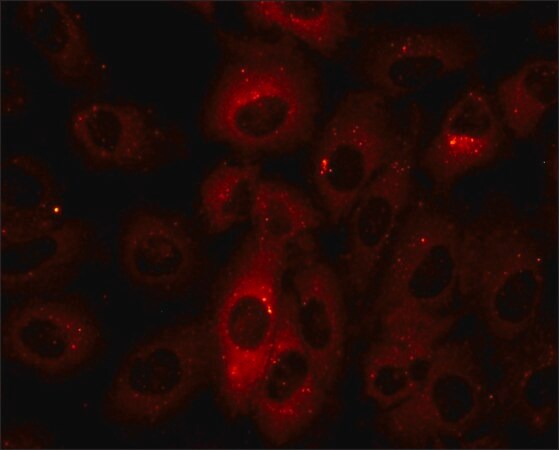 [P0067-25UL] Anti-p62/SQSTM1 antibody produced in rabbit (25 μL)