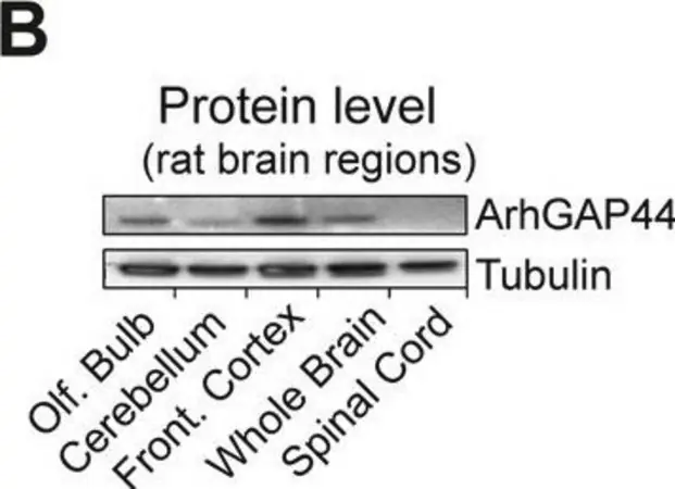 [T8578-25UL] Anti-β-Tubulin III (neuronal) antibody, Mouse monoclonal (25 μL)