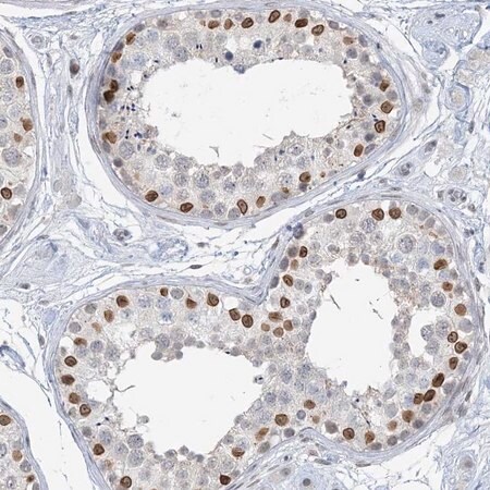 [HPA035977-100UL] Anti-KMT2D antibody produced in rabbit (100 μL)